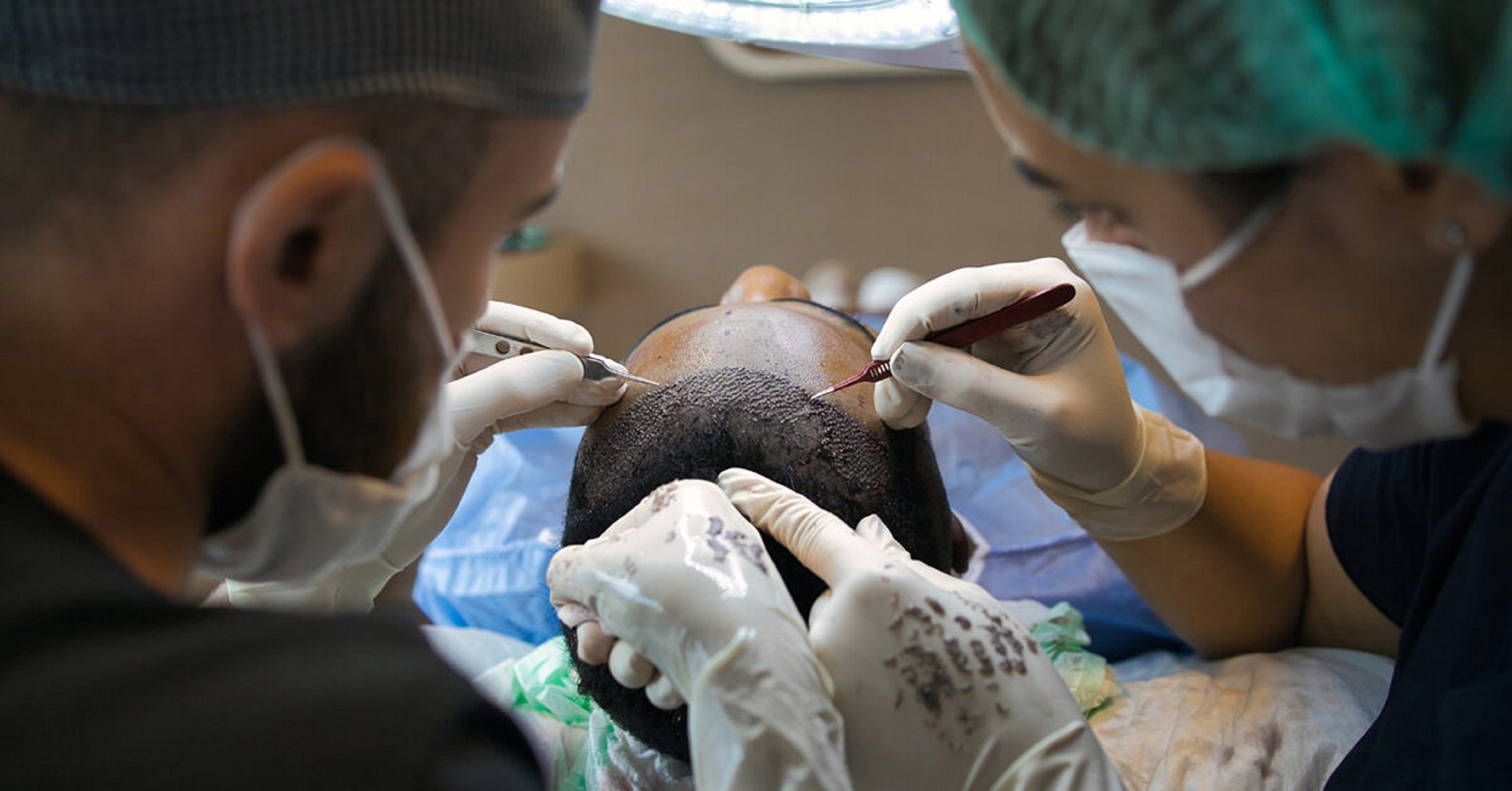 How To Choose The Right Hair Transplant Surgeon For You